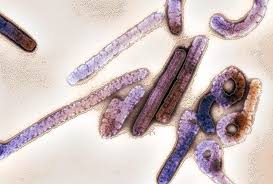 Ebola virus an rna virus almost identical to the marburg virus but serologically distinct; Marburg Virus Photograph By Ami Images Science Photo Library