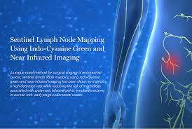 For example, this could be: The Way Forward For Endometrial Cancer Singhealth