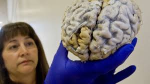 Sequester takes bite out of O.C. science research