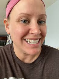 I'm so frustrated. I had 29 initial trays and bottom teeth were straight  but then I had to get a gum graft that wrapped stitches around my teeth and  shifted them and