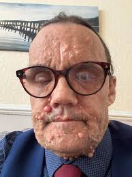 Well good morning I more test in this week a mri. I'm scared.