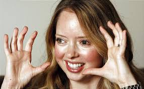 Pianist Desirae Brown looking at uncertain future because of rare eye  ailment