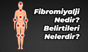 Fibromiyalji hastalarının ağrı eşiği düşük, ağrılı uyaranlara verdiği yanıt yüksek ve ağrı duyma süresi uzundur. Fibromiyalji Nedir Belirtileri Ve Fibromiyalji Tedavisi Trend Hayat
