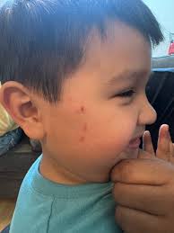 The family of a non-verbal special needs student, Destiny, is upset with  Knox County Schools' West High School in Tennessee after she was sent to  school and later required emergency medical attention,