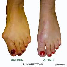 Pin On You And Your Feet