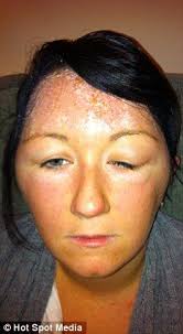 Before applying it, make sure that your hair is do a strand test to see how the color will affect your hair. 9 Hair Dye Dangers Ideas Dyed Hair Hair Dye