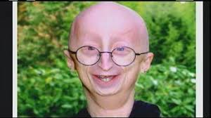 Remembering the inspiring Sam Berns