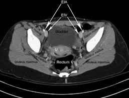 We did not find results for: Pelvis Ct Anatomy Anatomy Drawing Diagram