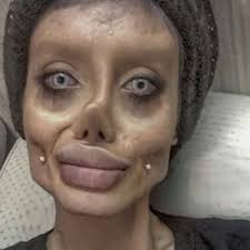 Surgery may be necessary to remove. Sahar Tabar Iran Instagram Star Known For Plastic Surgery Arrested For Blasphemy Iran The Guardian