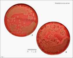The presumptive colonies of s. S Aureus Growing In A Petri Dish Colony Morphology And Hemolysis On Blood Agar