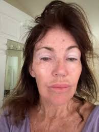 Petition · Protect Medicare and Private Insurance Coverage for Nonsurgical  Skin Cancer Treatment