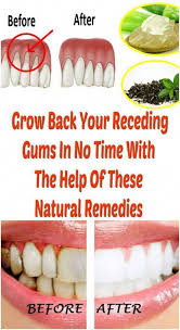 Ripe Tooth Extraction Healing Coconut Oil Dentistappointment Dentalimplantsbeforeandaftersearching Receding Gums Sensitive Teeth Remedy Sensitive Teeth