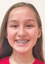 Summit Shasta volleyball