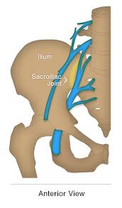 Is Your Sciatica Coming From Your Spine Or Your Si Joint Si Bone