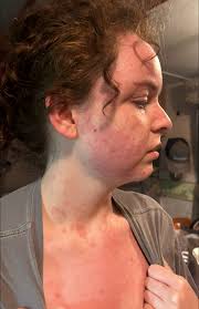 I live in FL and came home from being out of town for a long time. So i  hadn't been able to assess anything from after the hurricanes we got. I get