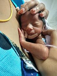 Kangaroo care - Wikipedia