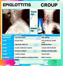 Image result for Acute Laryngitis