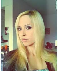 Cryoglobulinemia Stories