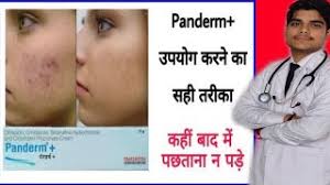 Panderm Cream Video Mp4 3gp Mp3 Download Full Hd As nystatin is also available in tablets and liquid form where it directly irritate intestinal mucosa and causing diarrhea, nausea, stomach pain and/or skin rashes. panderm cream video mp4 3gp mp3