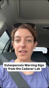 Storytime with Rebekah here! 🙋‍♀️ I wanted to share my reminder from the  human anatomy dissection lab over the weekend as a reminder about bone  health, osteoporosis, and sarcopenia and why NOW in ...