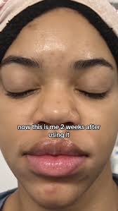 Amazon.com: OxyGlow 2 Cordless Portable Facial Wand, ProFacialWand Clinical  Skin Therapy Wand