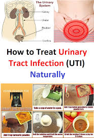 How To Treat Urinary Tract Infection Uti Naturally In 2020 Urinary Tract Infection Urinary Tract Infection Remedies Urinary Tract