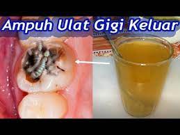 Untuk membantu mencegah gigi berlubang, dikeluarkanlah pepsodent pencegah gigi berlubang. 62 Gambar Cacing Gigi Paling Bagus Gambar Pixabay
