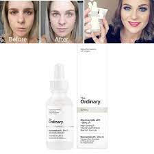 I did a patch test before introducing the ordinary niacinamide 10% + zinc 1% into my skincare. The Ordinary Niacinamide 10 Zinc 1 30ml Face Serum Reduce Acne Pigmentation Facial Whitening Liquid Serum Anti Aging Wish