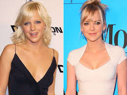 Stars Who Love Their Plastic Surgery (Photos)