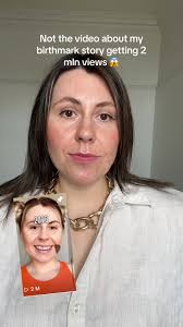 Part 2 Anna Birthmark