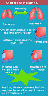 This topic provides an overview of upper and middle back pain. Pin On Unlock Hip Flexor Tips