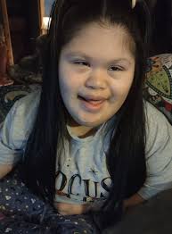 Hello Everyone ! Meet my Little Girl She's now 13 days old , do you think  she have a Down Syndrome ? Thank you 😊 .