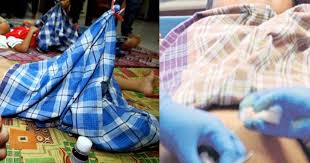 Selepas selesai bersunat, ibu ayah dinasihatkan untuk membuka balutan gauze selepas 48 jam, atau selepas 2 hari. Supaya Cepat Sembuh Doktor Ini Sedia 10 Tip Penjagaan Luka Berkhatan Boleh Follow Keluarga