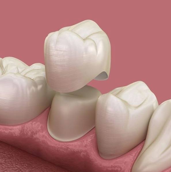 Zirconia Crowns product image