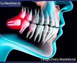 Cirugia Oral y Maxilofacial - La Dentisteria