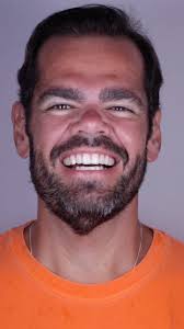 🔹Muito feliz com essa linda transformação! , 🔹Paciente insatisfeito com  os espaços entre os dentes e a posição dos caninos, com 6 lentes  conseguimos fazer a correção do sorriso deixando lindo é ...