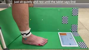 Image result for Rest Tremor