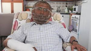 Recall the worst flu you've ever had and the angriest you've ever been, then combine those with clenching every muscle in your body for weeks on end. Man Locks His Head In Cage In Attempt To Stop Smoking