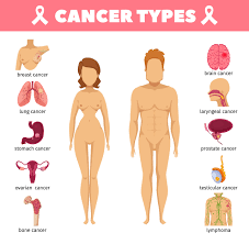 They can affect your digestion, such as What Kind Of Cancer Does Roundup Cause Pintas Mullins Law Firm
