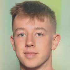 Why my comet have halo shape in comet assay ?