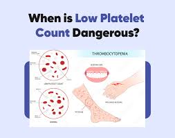 Image result for Platelet Dysfunction