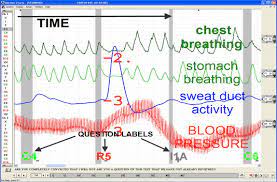 A lie detector machine is not accurate in detecting lies, just in measuring reactions. Axciton Systems Inc
