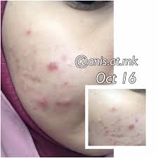 Lebih 50 tahun mary kay bertahan dalam industry kecantikan. Pengalaman Pertama Menggunakan Mary Kay
