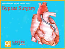 Image result for stay and treatment where the treatment is bypass surgery. what additional information