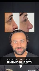 Here is all you need to know