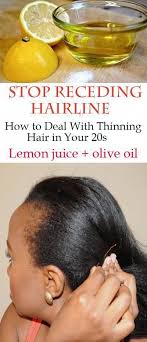 The best hairstyles for receding hairlines undercut Receding Hairline In Women Causes And Best Natural Treatments Receding Hairline Hairline Natural Receding Hairline Treatment Hair Loss Women Regrow Hair