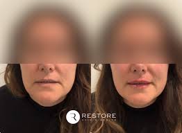 Restore Skin & Health