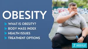 Image result for Obesity