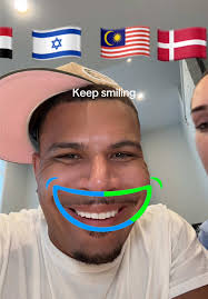 Journey to a Hair Transplant: Our Australian-Turkish Vibe