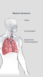 This disease is more contagious than influenza such that cluster outbreaks occur frequently. Corona Im Korper